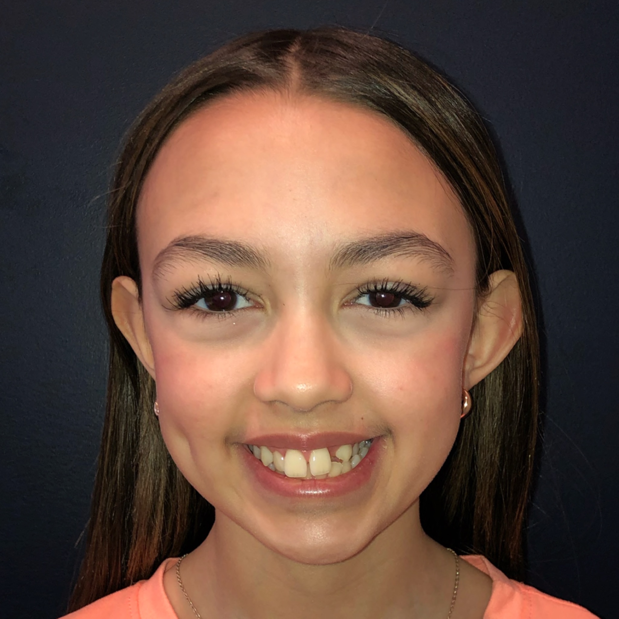 Case One before smile photo