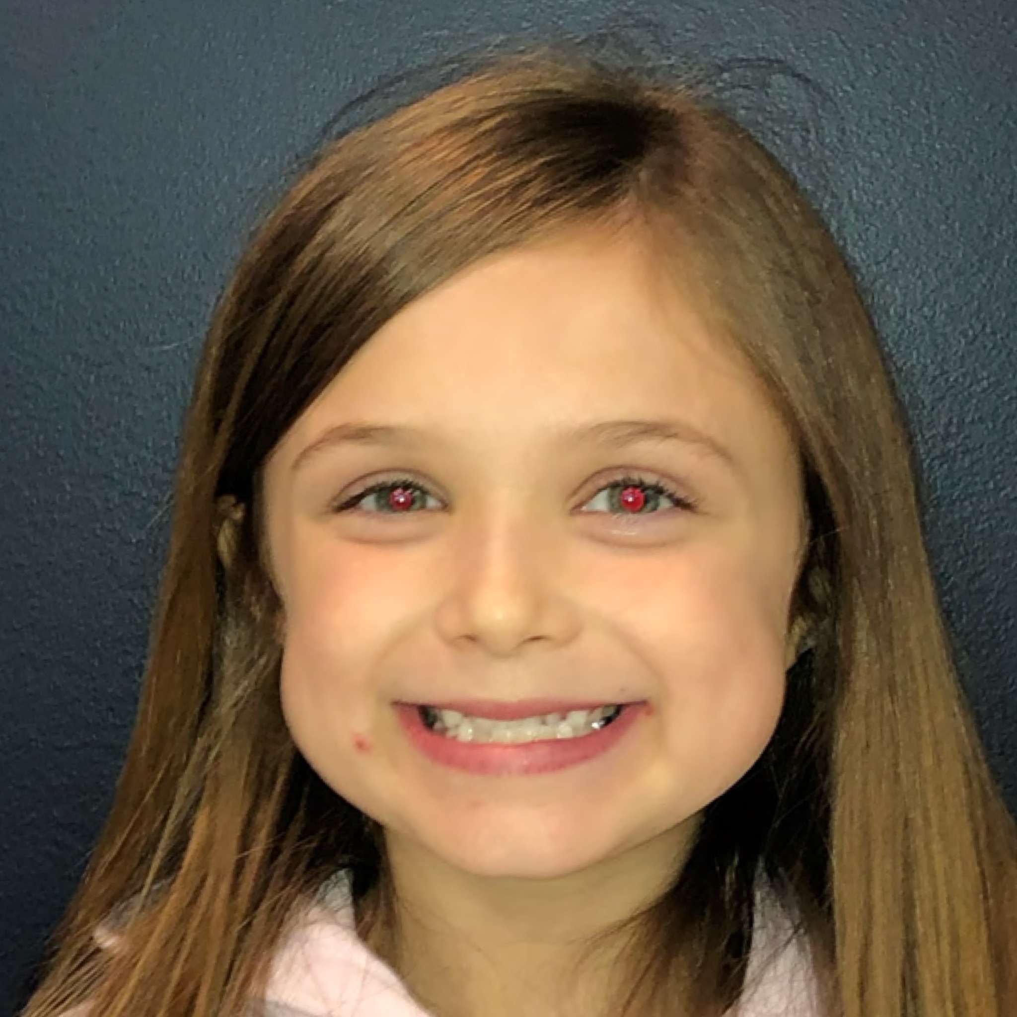 Case Two before smile photo