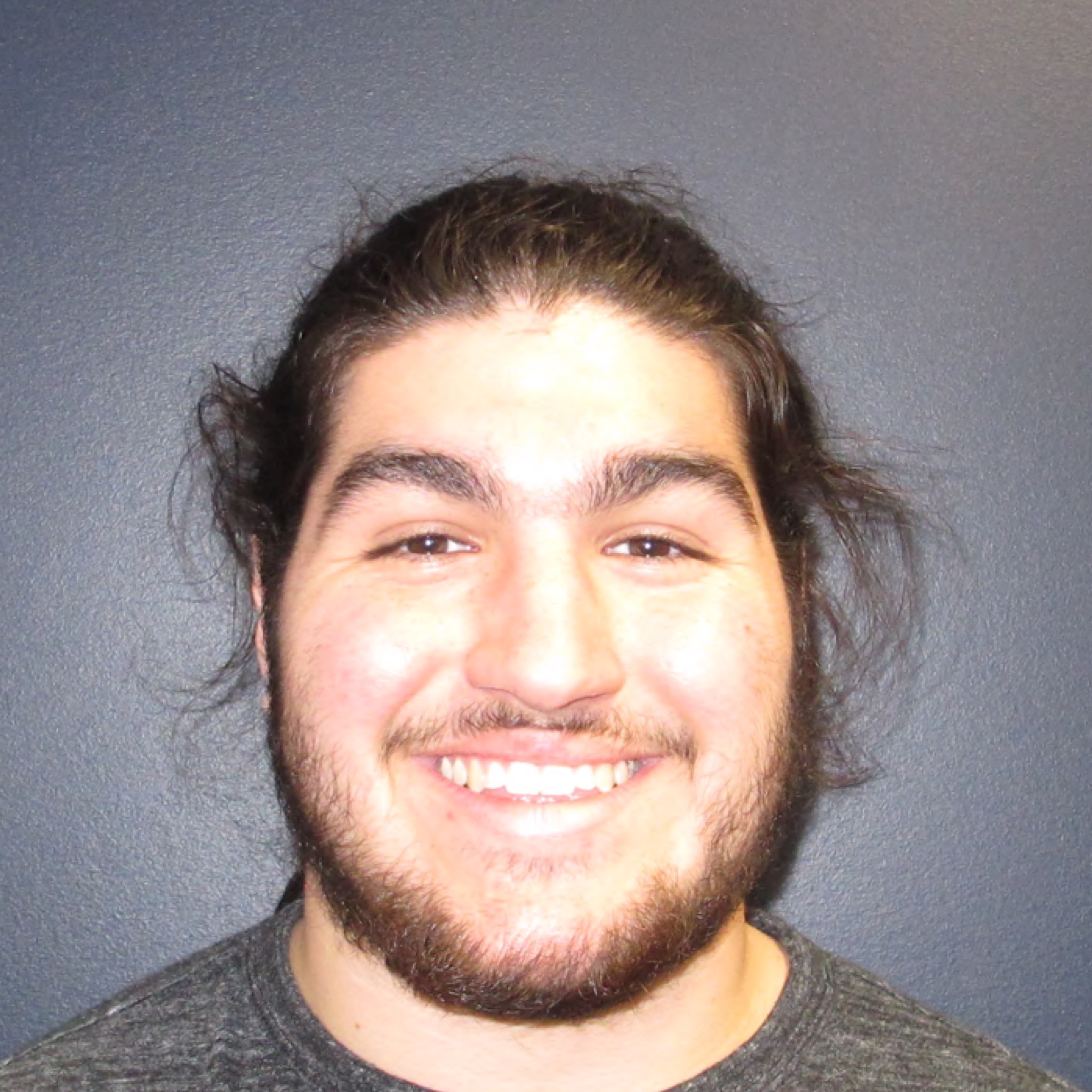 Case Three before smile photo