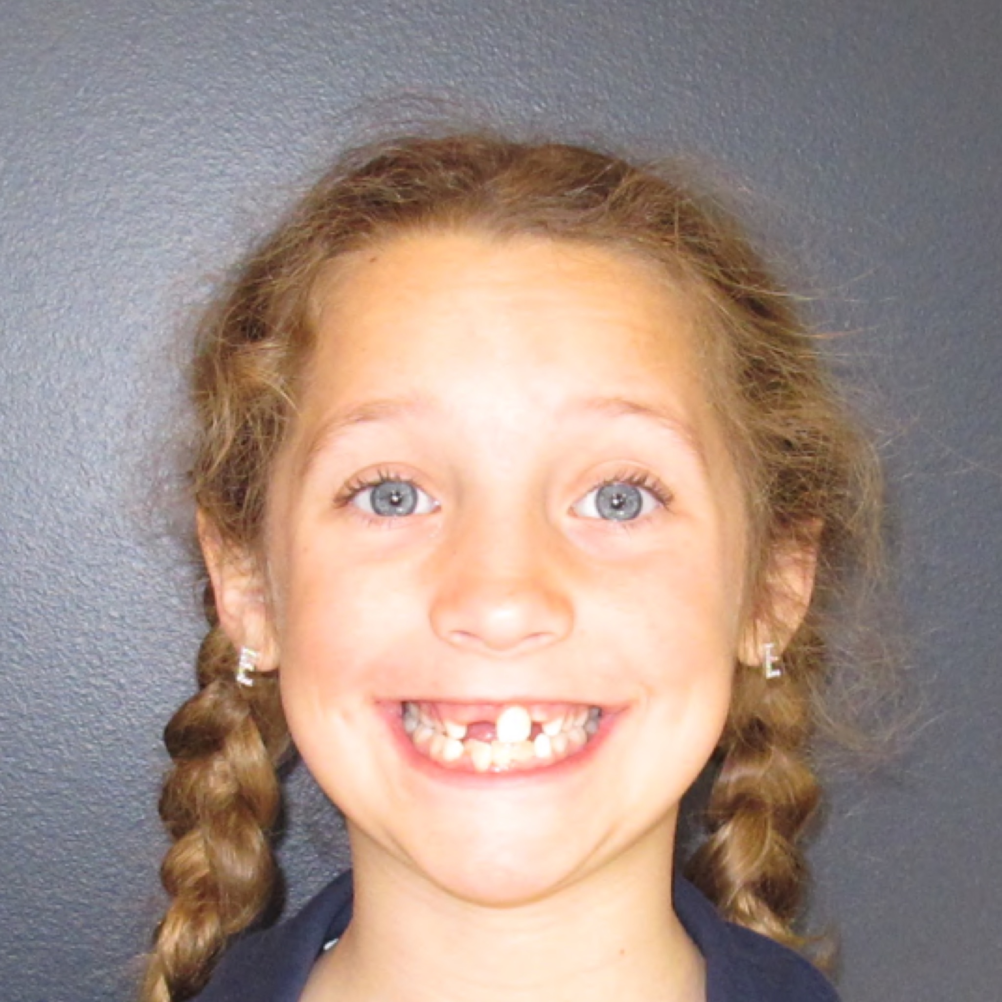 Case Six before smile photo