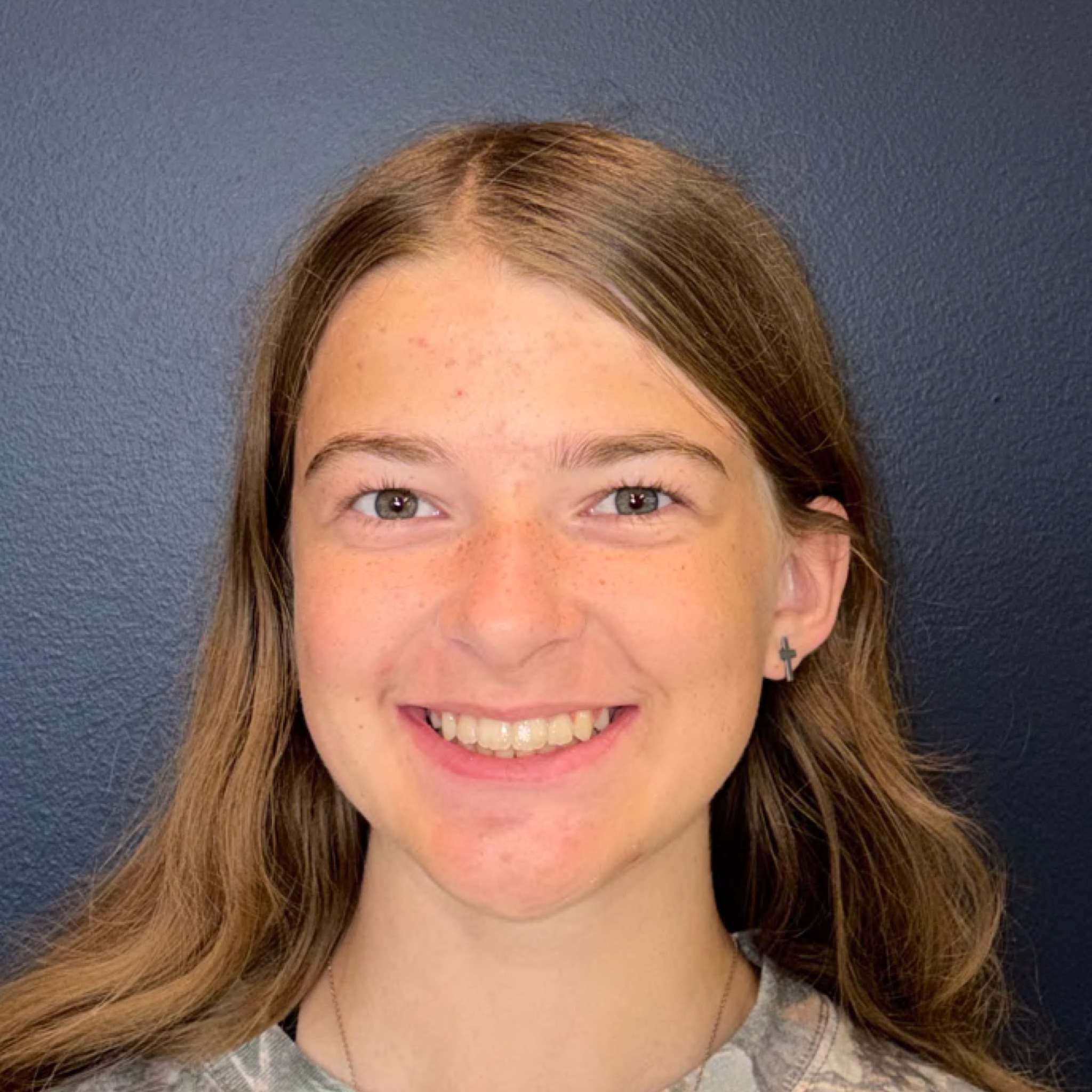 Case Seven after smile photo