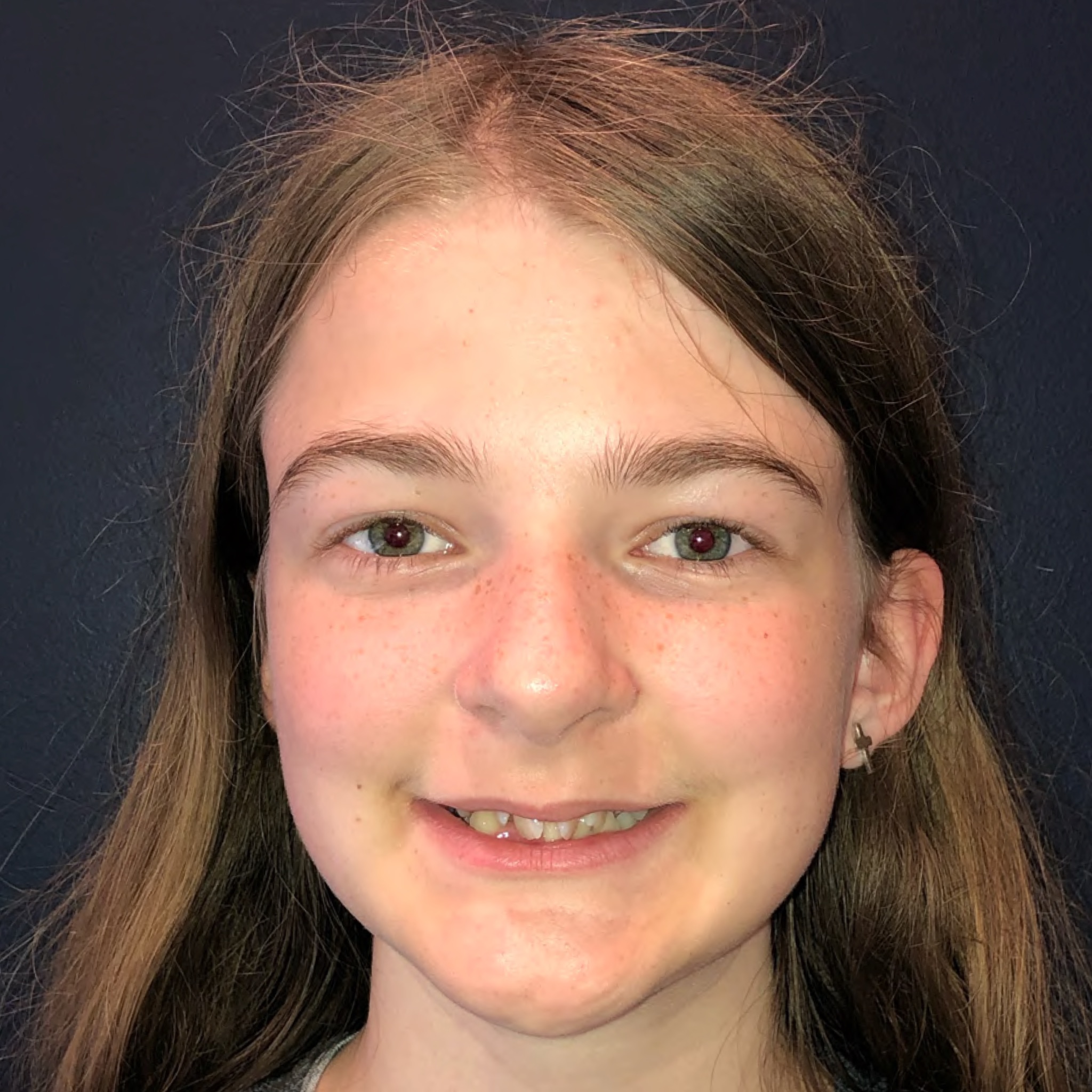 Case Seven before smile photo