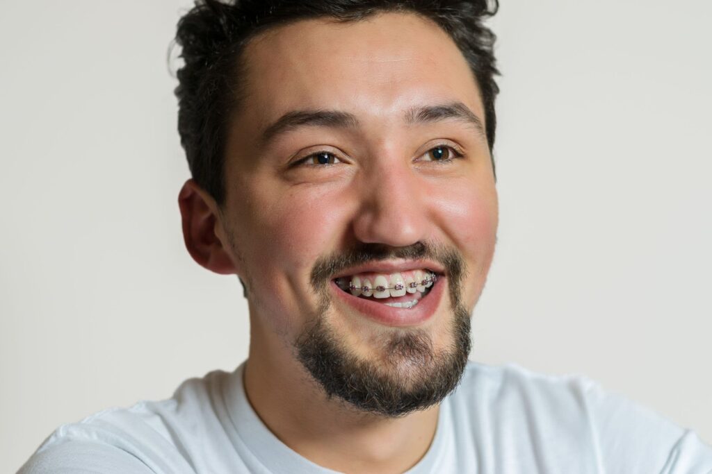 Adult man smiling with braces