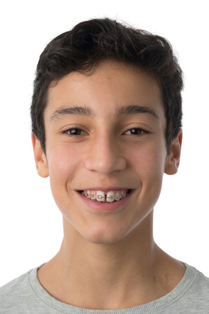 Close-up of a boy smiling with braces