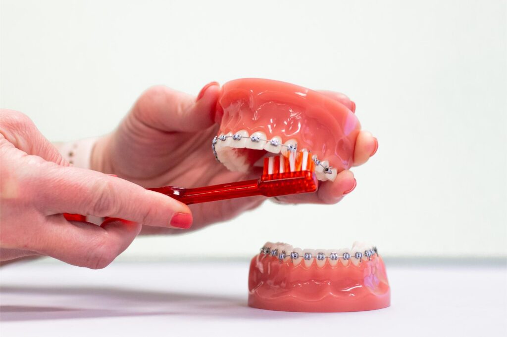 Brushing braces on a teeth model with a toothbrush